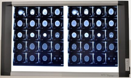 X-RAY VIEWER (DOUBLE SCREEN)